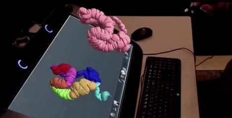 精準醫(yī)療新篇章 3D打印與虛擬現(xiàn)實融合開創(chuàng)外科手術(shù)新紀元